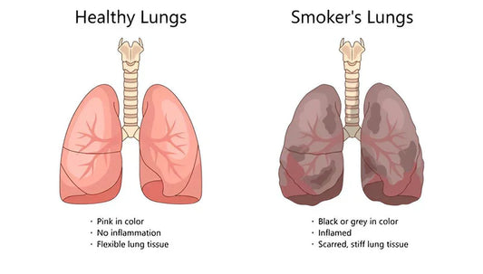 Are You All Set to Crush the Craving for Good? Here's How to Breathe Free Again!